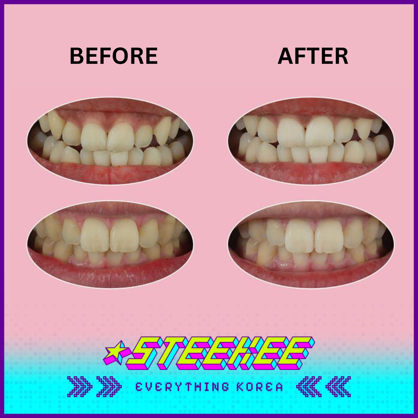 Hello Kitty X Euthymol Whitening Toothpaste 106g with Hairband by Steekee Korea 2426