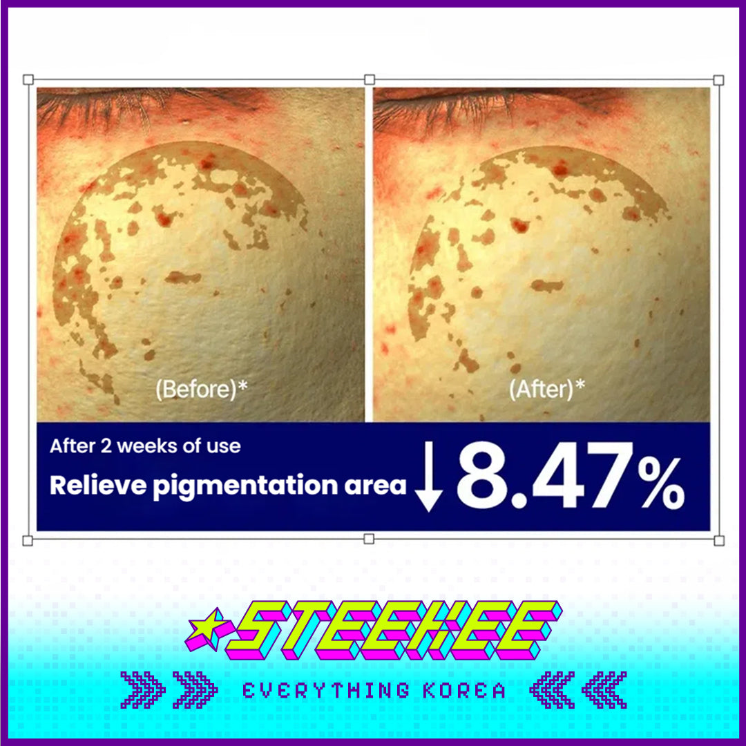 奥嘉娜Bio Actiome维他爽肤水凝胶美白面膜闪奇韩国4001