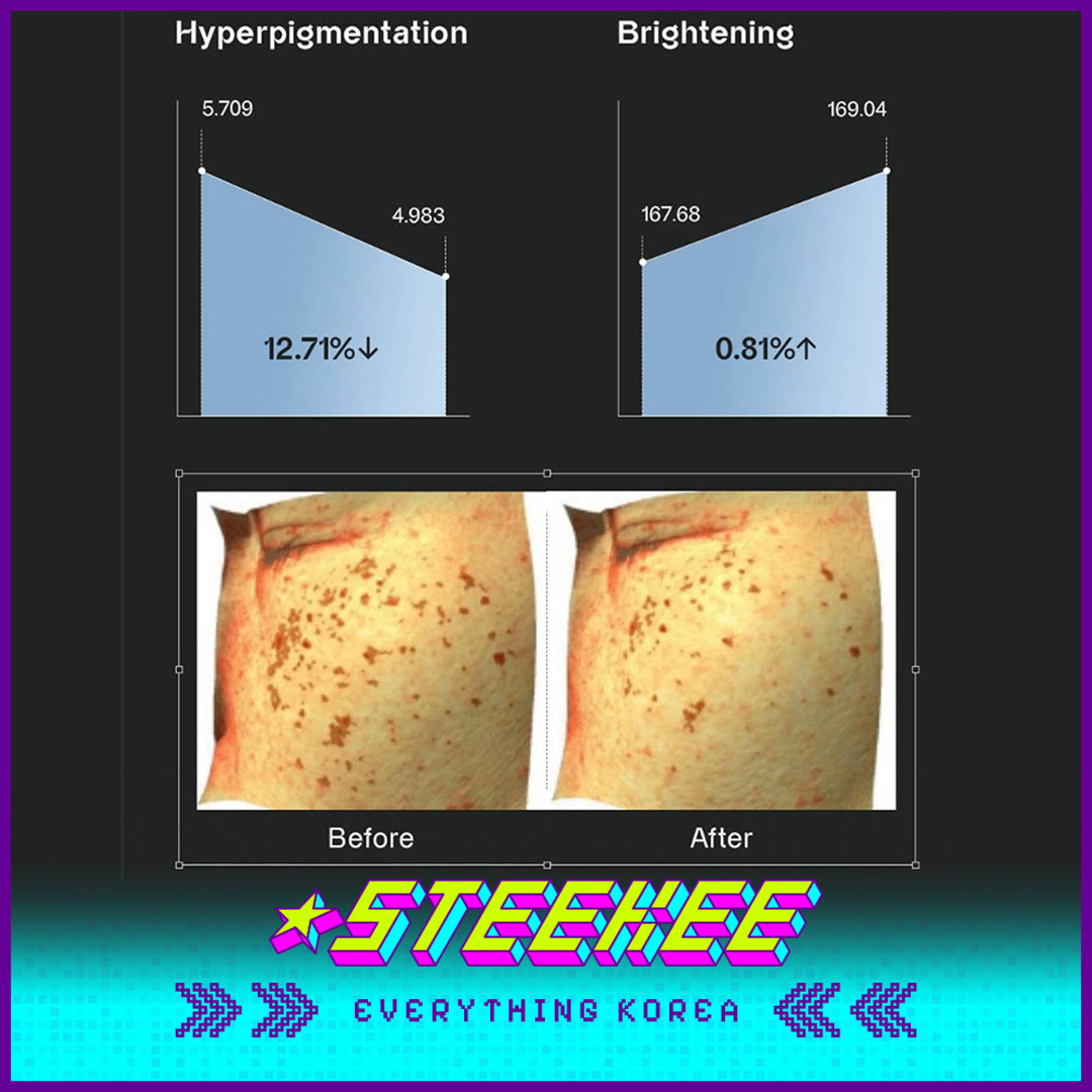 奥嘉娜Bio Actiome美白护理爽肤水120ml闪奇韩国4014