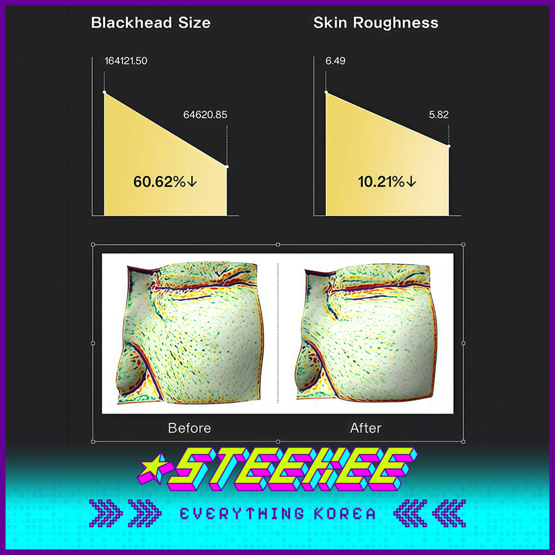 奥嘉娜DERX小气泡核桃去角质洁面洗脸霜10ml旅行小样套装闪奇韩国4019