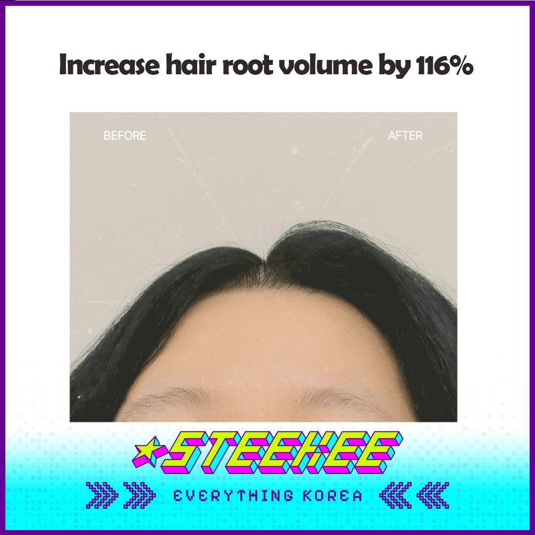 Hetras Premium Hair Care Simkong Fragrance Anti-Hair Loss Shampoo 1013ml by Steekee Korea 4376