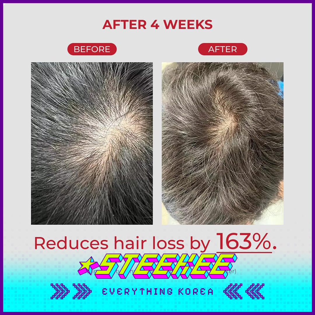 Moev Apple Anti Hair Loss Tough Hair Volumizing Luxury Shampoo 525ml by Steekee Korea 4095